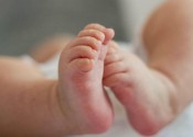 Malformazione polmonari congenite, 3 bimbi operati a Milano Tutti sotto l'anno di vita, interventi a giugno in 10 giorni 